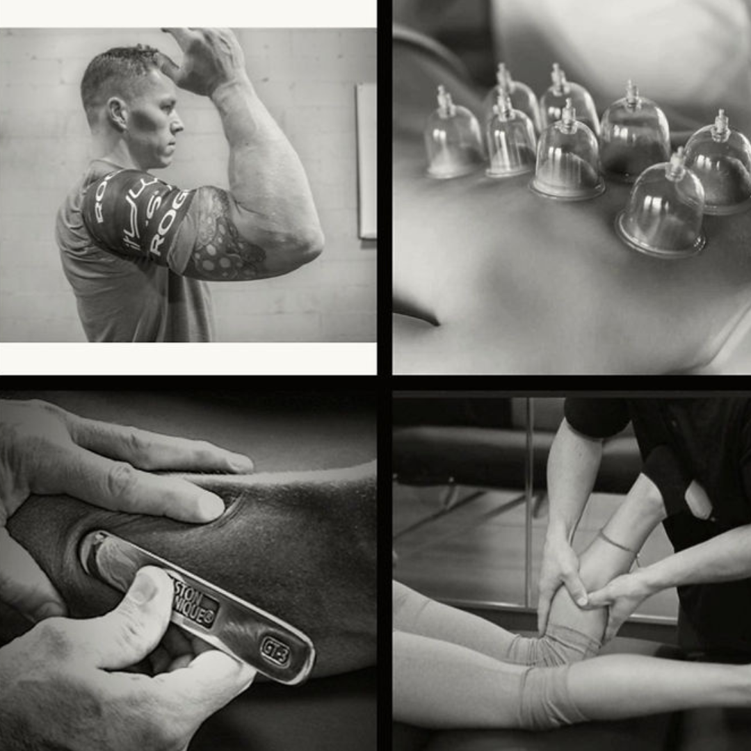 The image shows four different types of physical therapy or recovery treatments: A person is stretching their arm, possibly after a workout. Cupping therapy is being applied to a person’s back. A hand is using a scraping tool (Gua Sha) on a person’s arm. A practitioner is performing a stretching technique on a person’s leg.